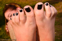 pale feet black toenails